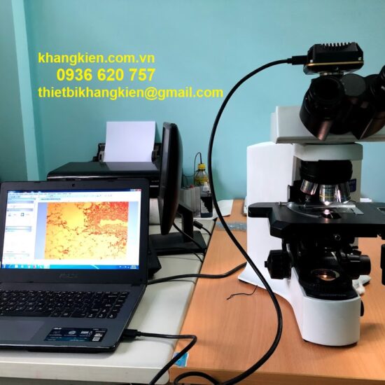 Nên chọn camera nào cho kính hiển vi ba mắt - 0936 620 757
